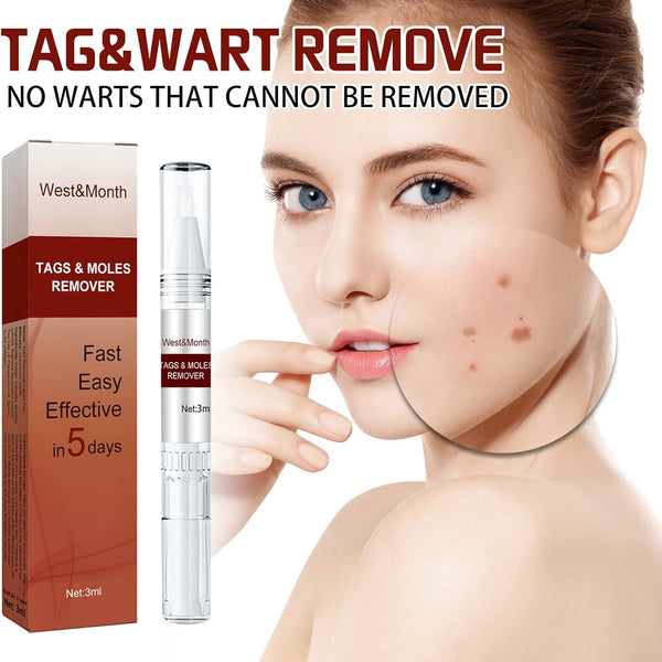 Tags and Moles Remover - Effortlessly Remove Skin Tags and Moles