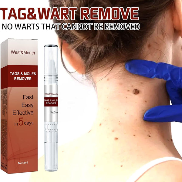 Tags and Moles Remover - Effortlessly Remove Skin Tags and Moles